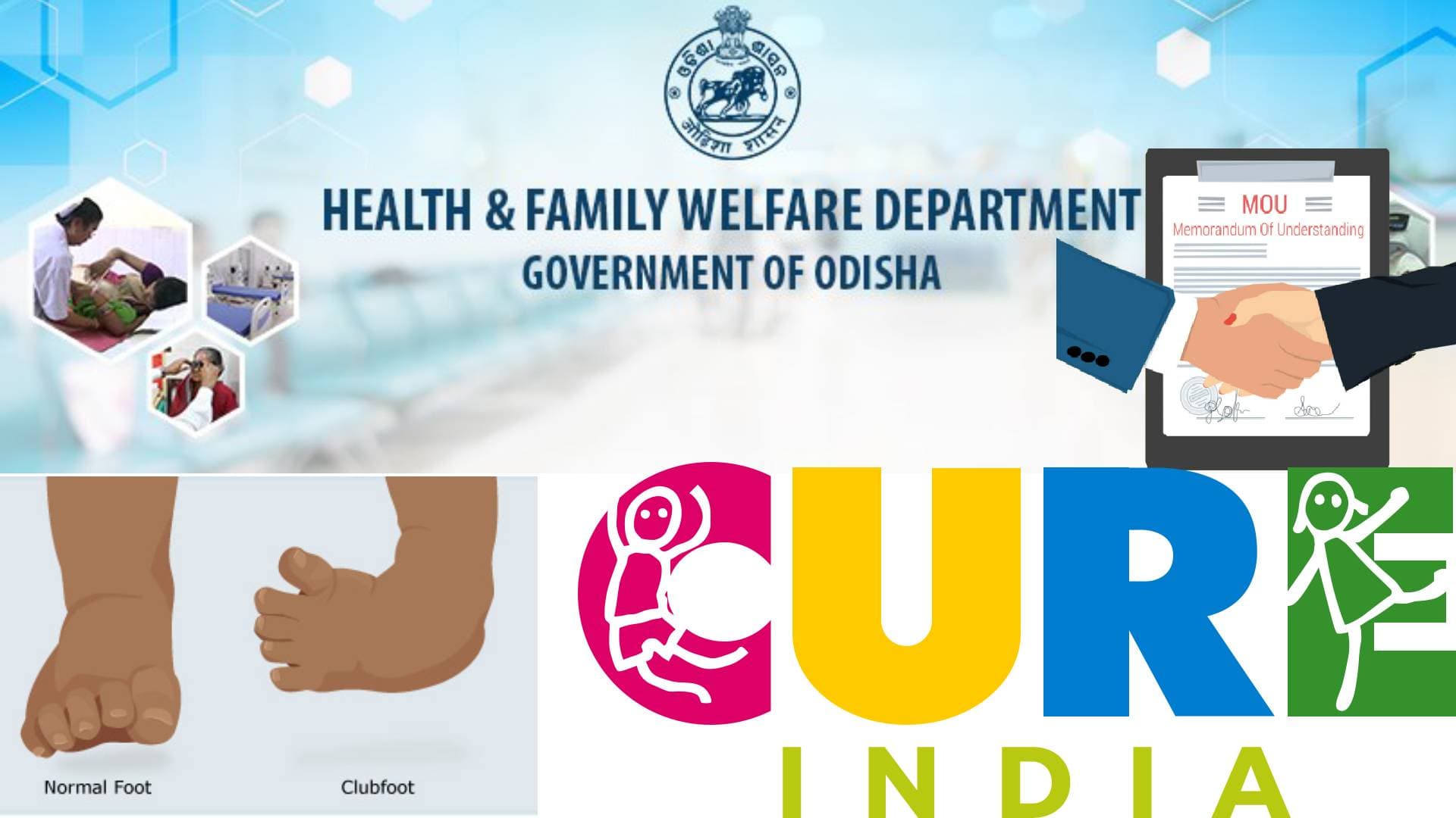 Vision To Cure Disability Caused By Clubfoot: Odisha Govt Signs MoU With CURE India