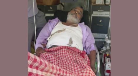Water Resources Employee Critical As He Comes In Contact With Live 33-kv Wire