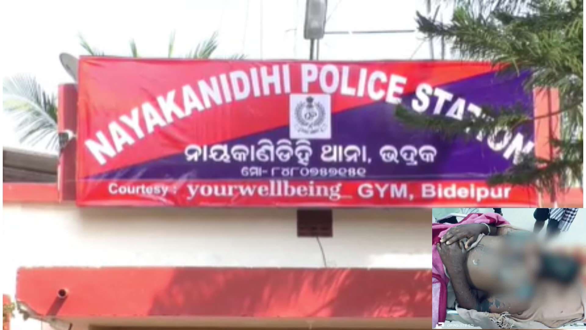 Bhadrak: Youth Injured In Acid Attack, Hospitalised