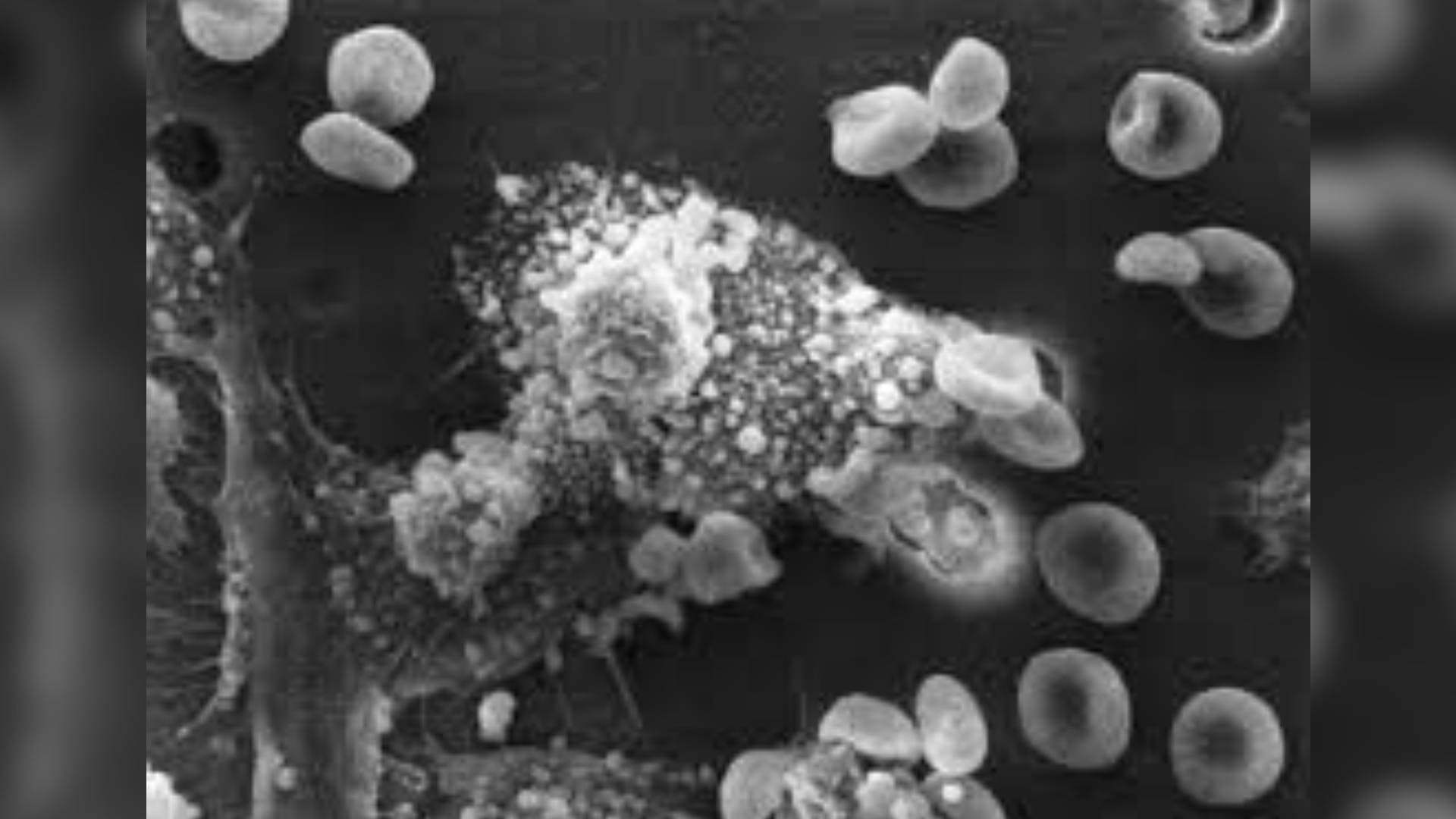 New Method Turns Tumour-Supporting Cells Into Killers