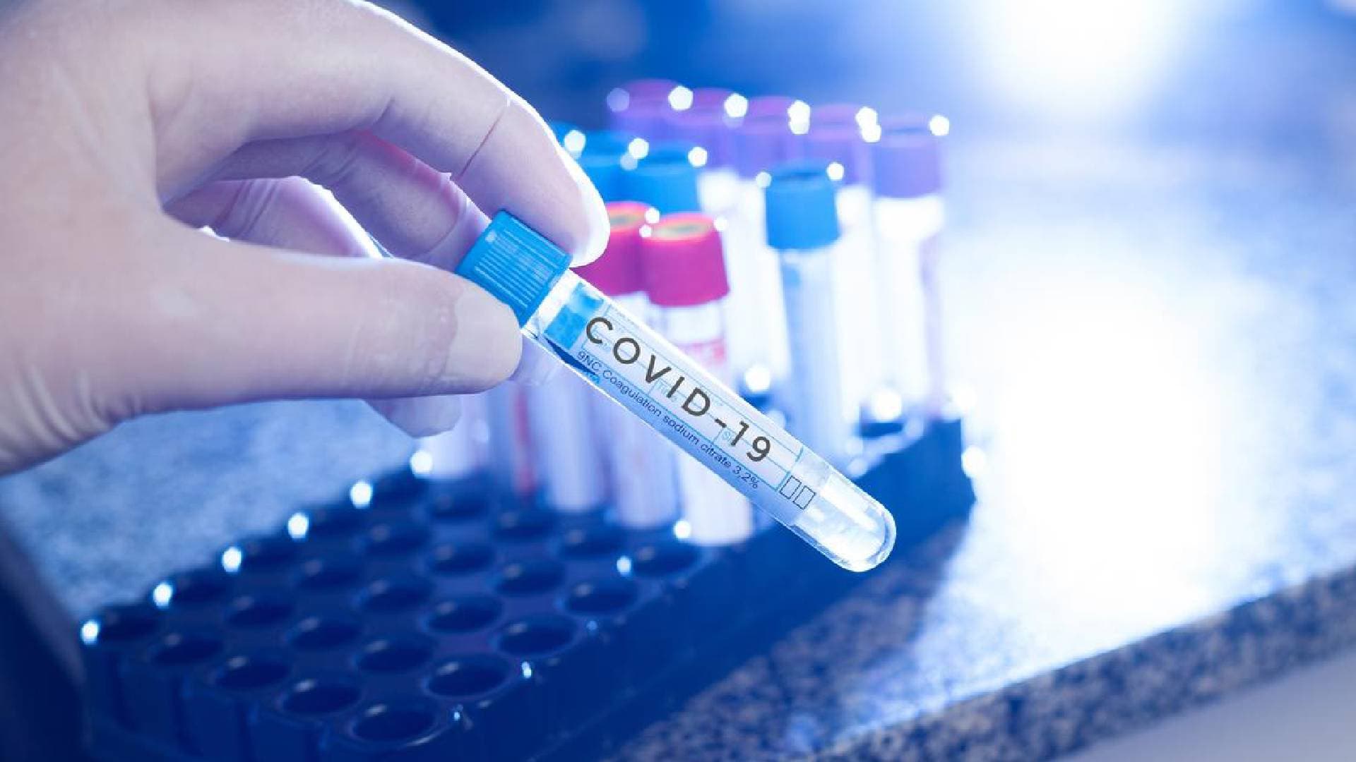Odisha Detects Second COVID-Positive Case Amid Growing Concerns