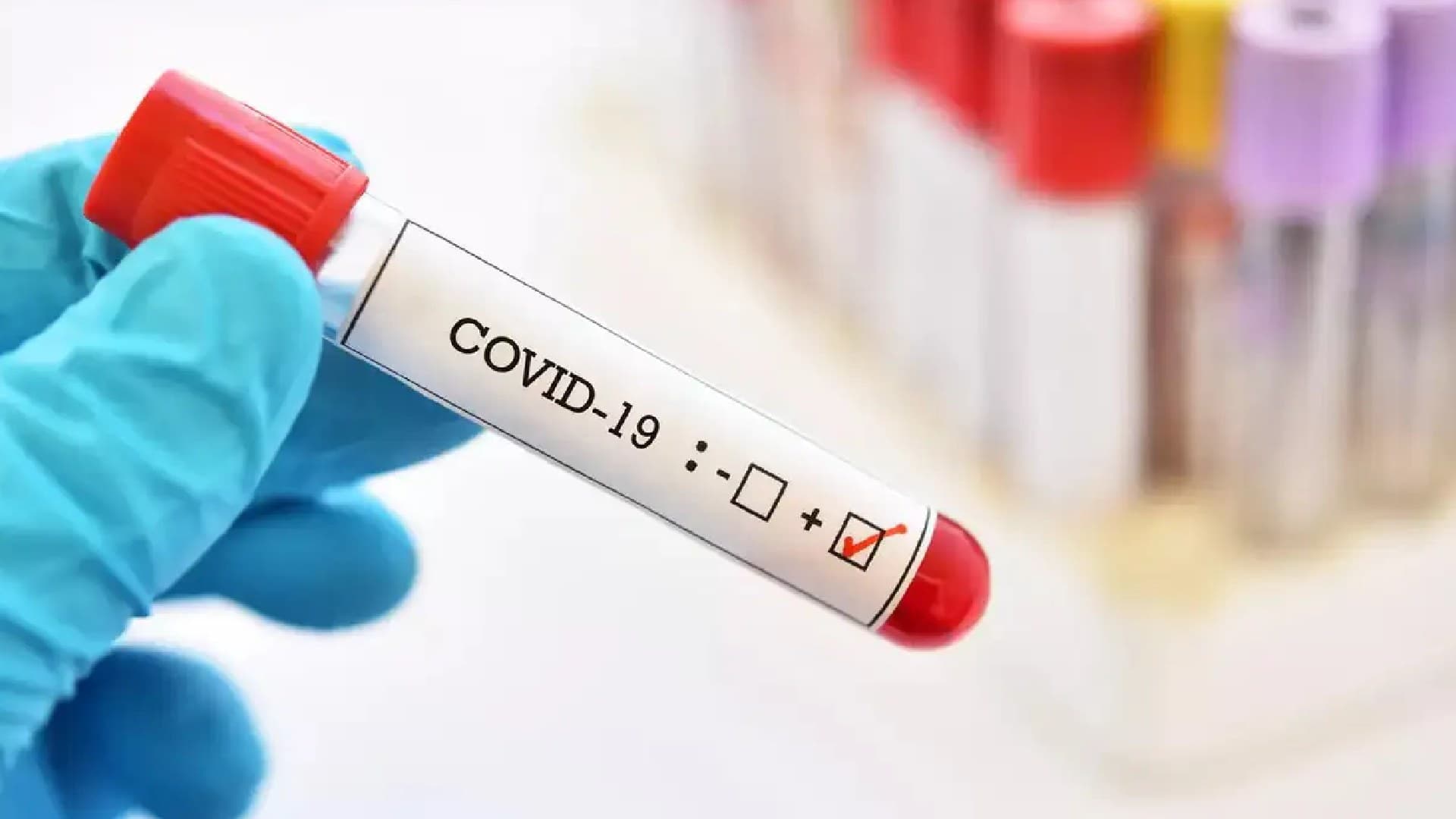 Odisha Records First COVID Fatality: Bhubaneswar Woman Succumbs to Virus