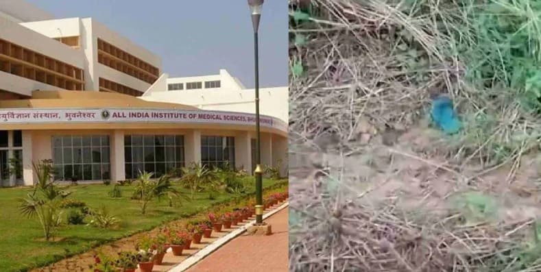 Puri Burn Victim’s Statement Recorded At AIIMS Bhubaneswar, Next 48 Hours Critical
