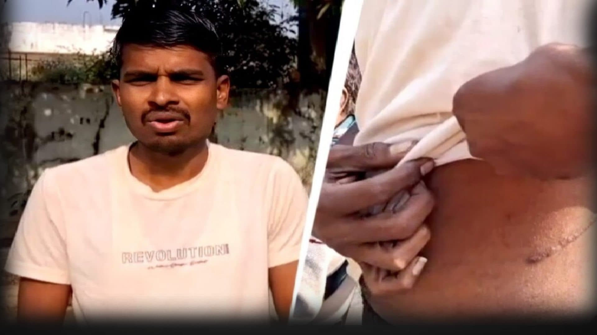 A Kidney for a ₹1 Lakh Loan! Debt Trap Drives Maharashtra Farmer to Desperate Choice