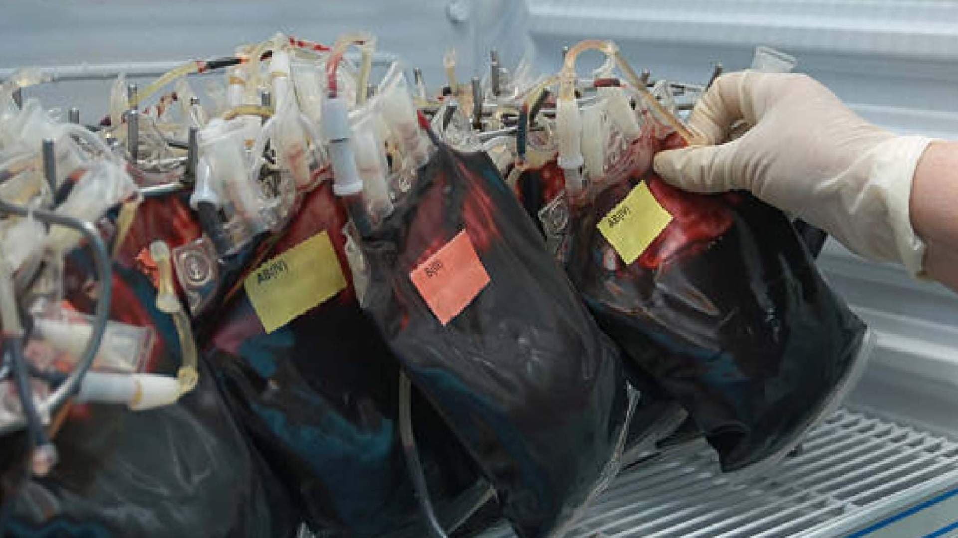 Hyderabad Police Find Goat, Sheep Blood in Human Blood Storage Bags