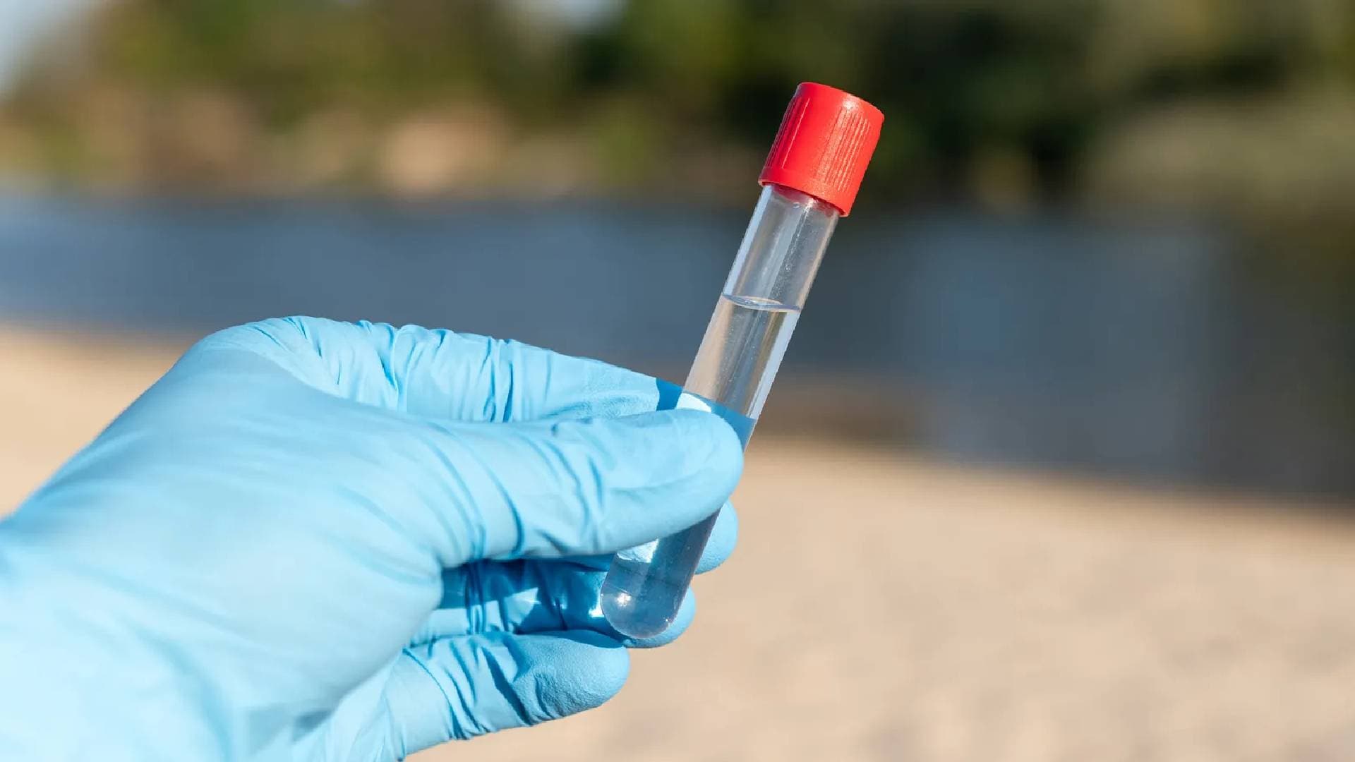 Antibiotics From Human Use Are Contaminating Rivers Worldwide: Study