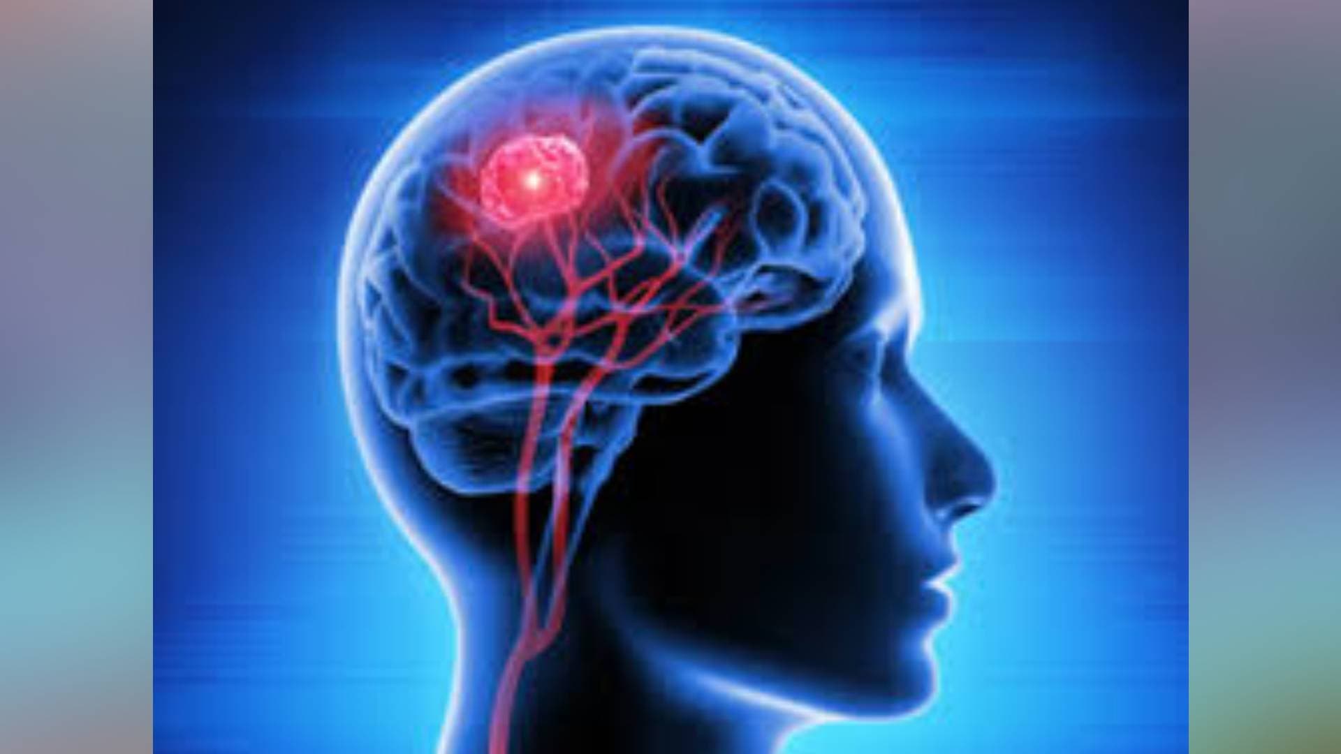 A Busier Social Life May Signal Alzheimer’s Risk, Says Study