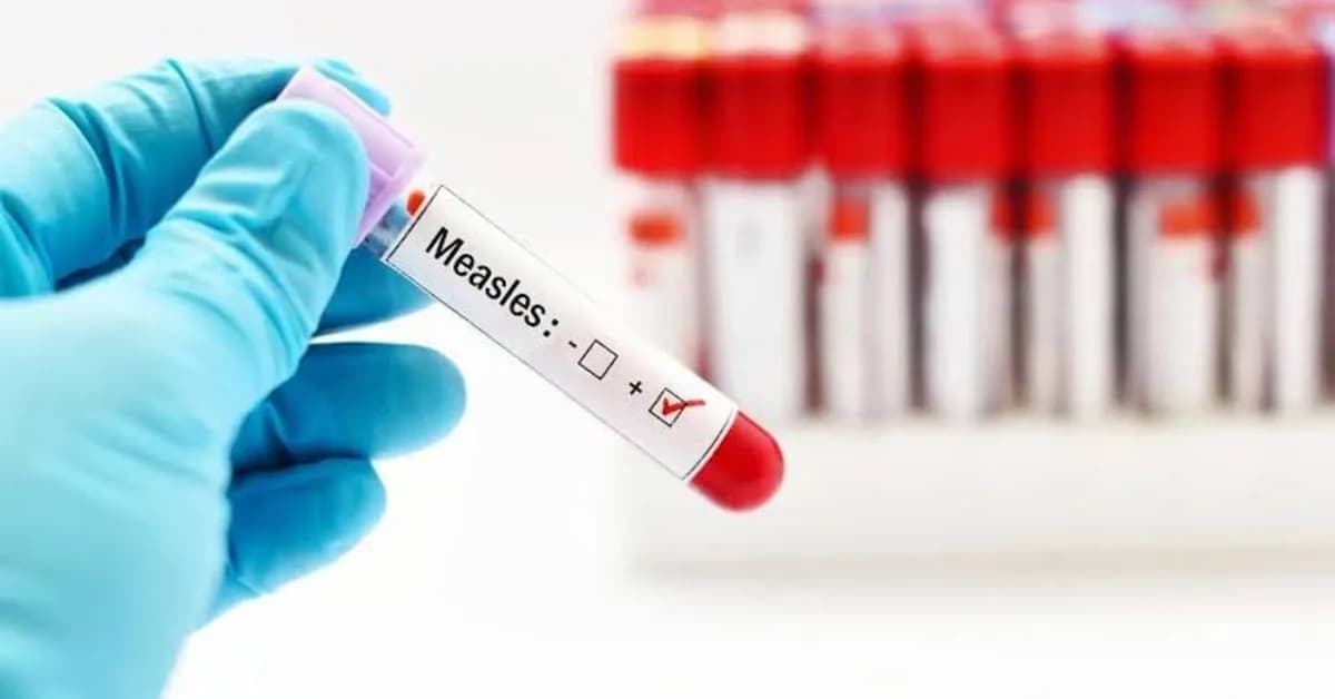 New York Declares Statewide Emergency as Measles Cases Surge Across US