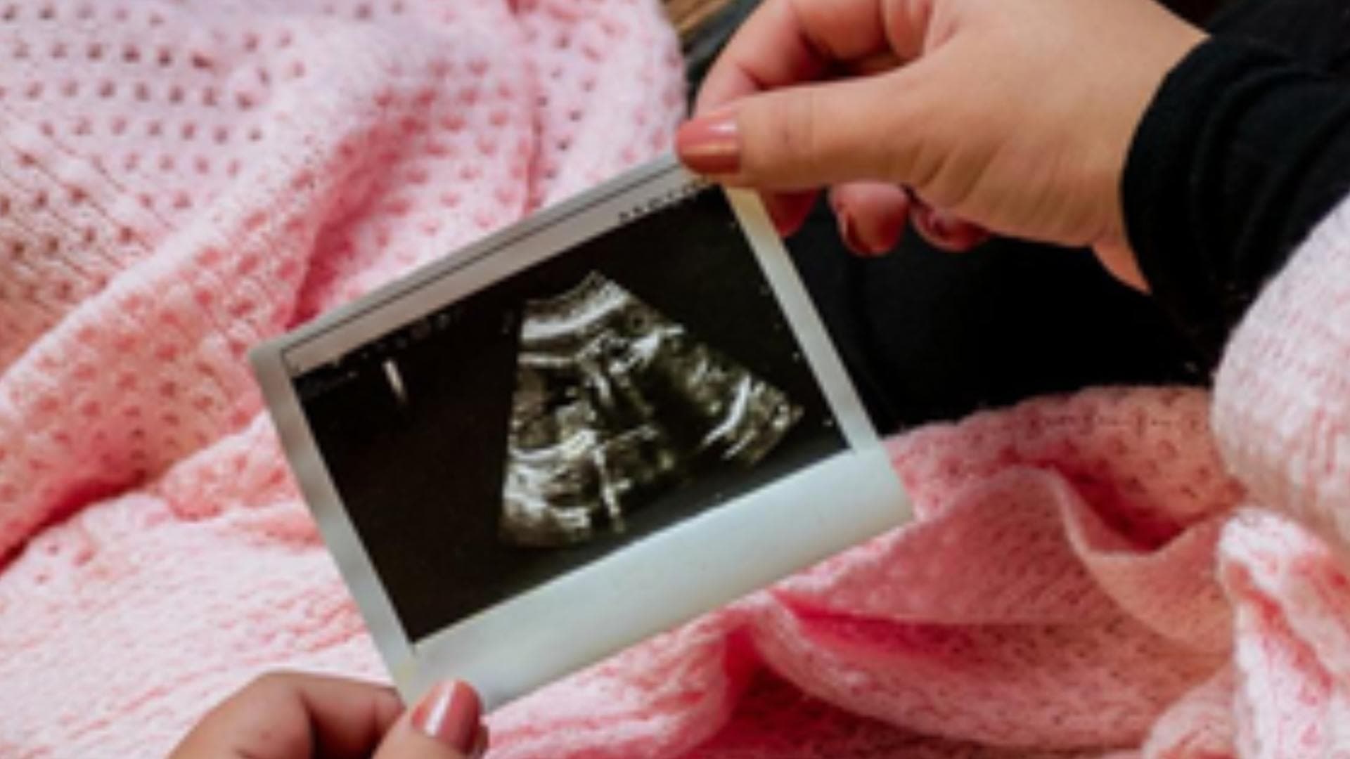 Govt Amends Surrogacy Rules, Govt Employees To Get 6-Month Break