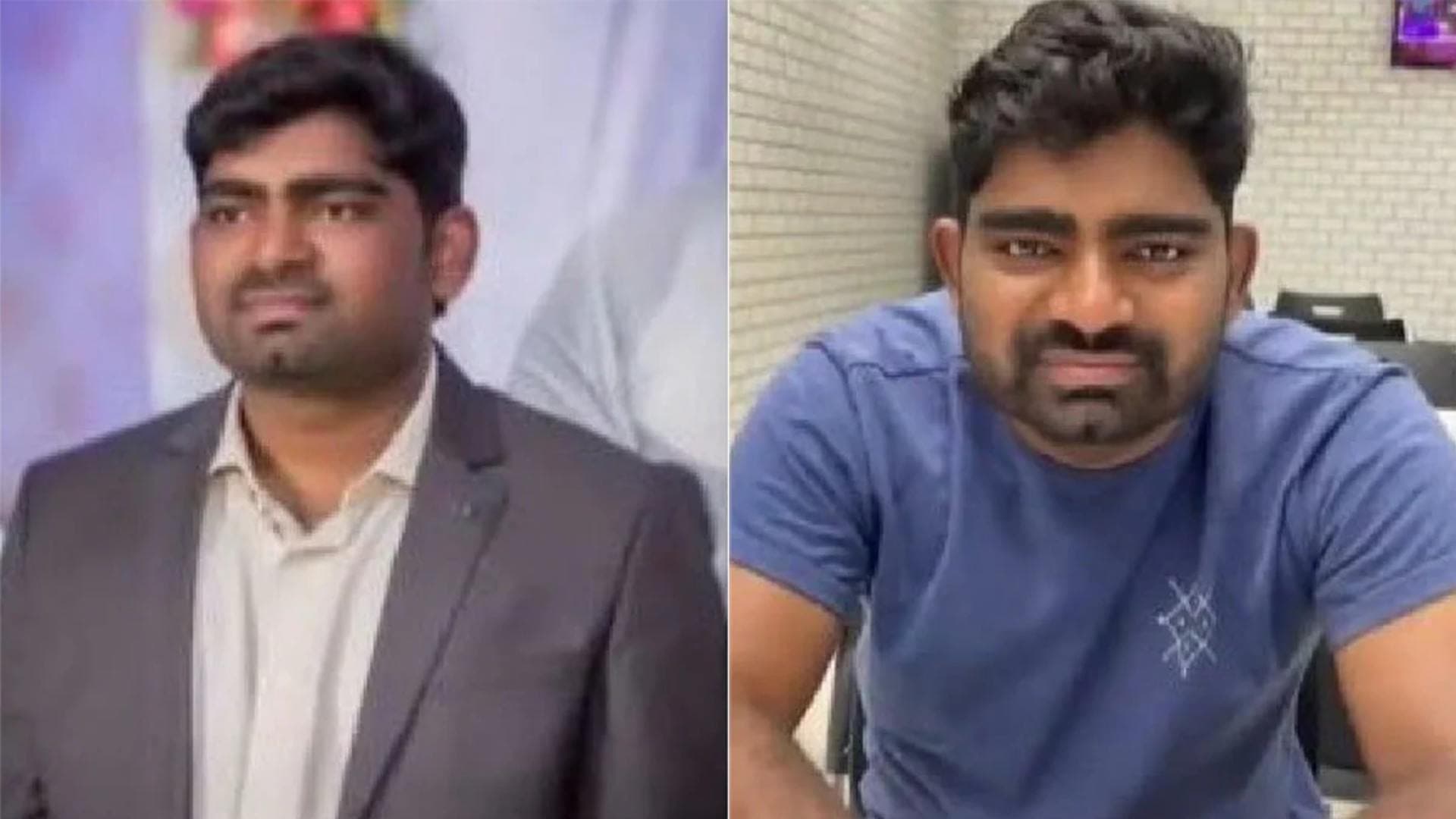 Man Dies During 'Smile Designing' Surgery Weeks Before Wedding